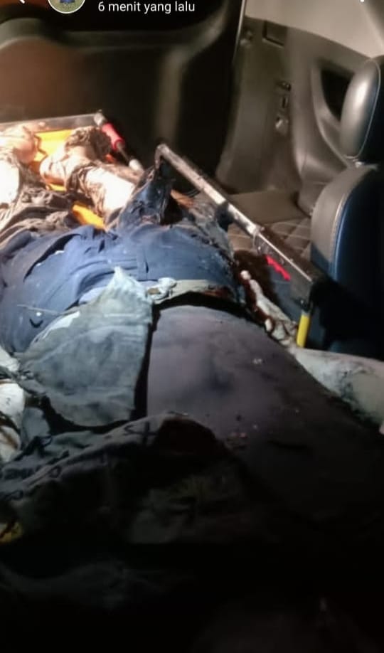 Salah seorang korban dalam peristiwa kebakaran di pabrik PT Sari Dumai Oleo.